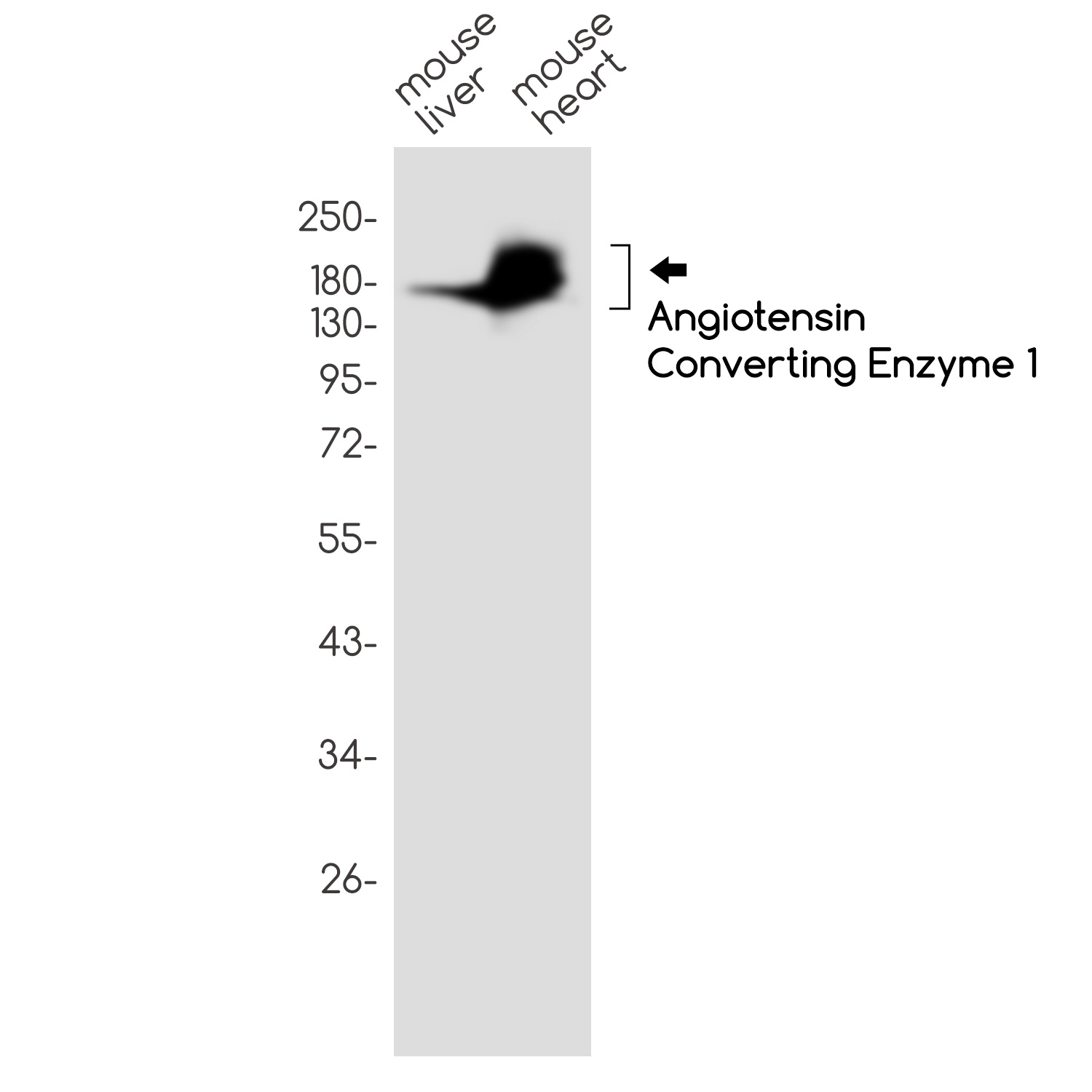 Angiotensin Converting Enzyme 1 Rabbit mAb