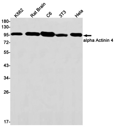 ACTN4 Antibody