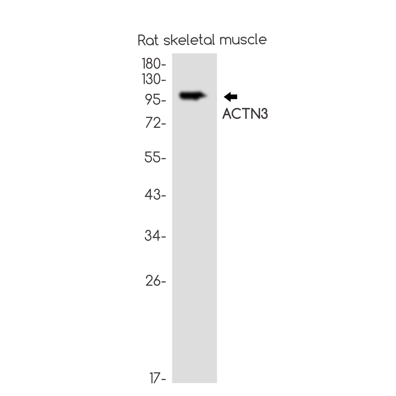 ACTN3 Antibody