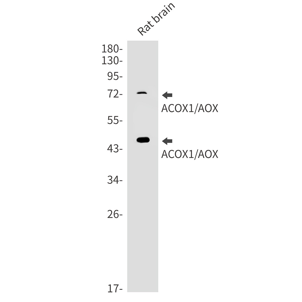 ACOX1 Rabbit mAb