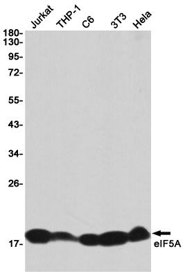 eIF5A Rabbit mAb