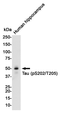 MAPT Antibody