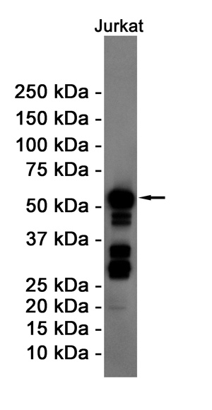 [KD] Cyclin B1 Rabbit mAb