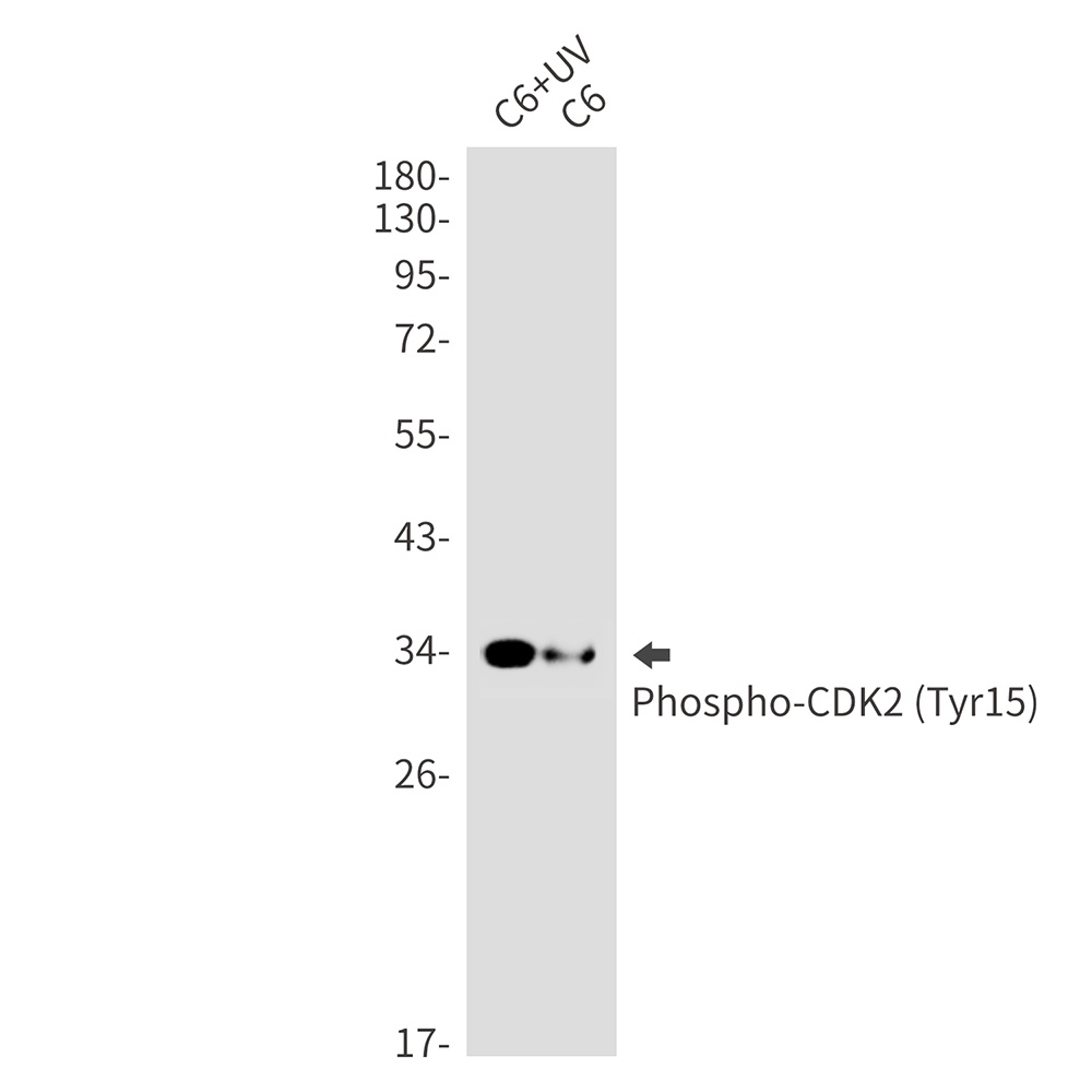 Phospho-CDK2 (Tyr15) Rabbit mAb