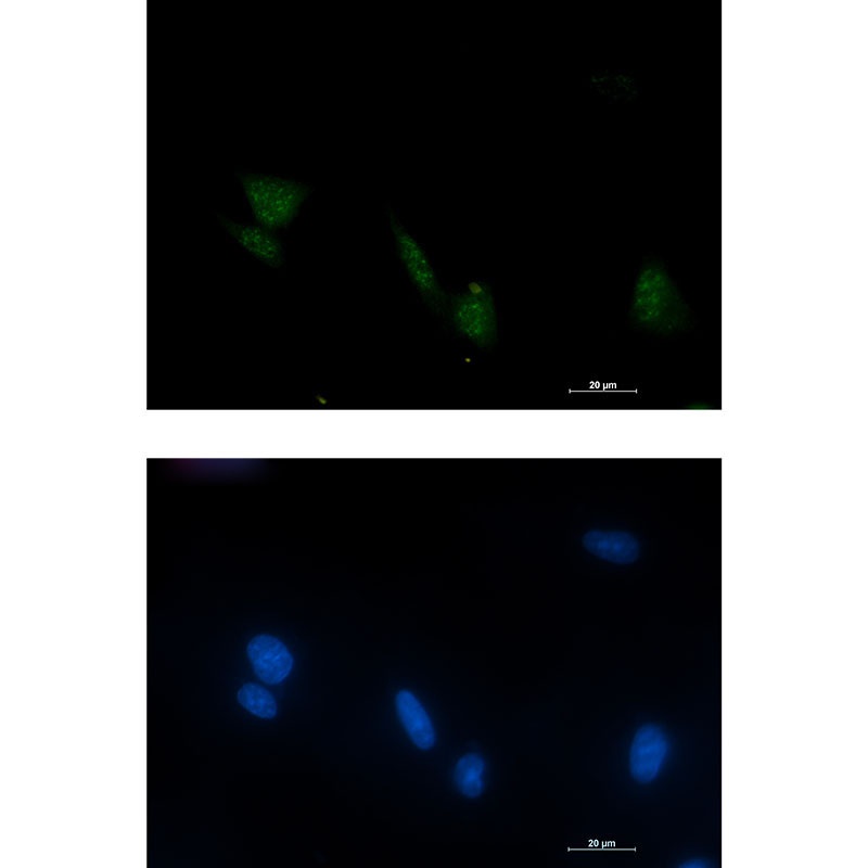 RPS6KA6 Antibody