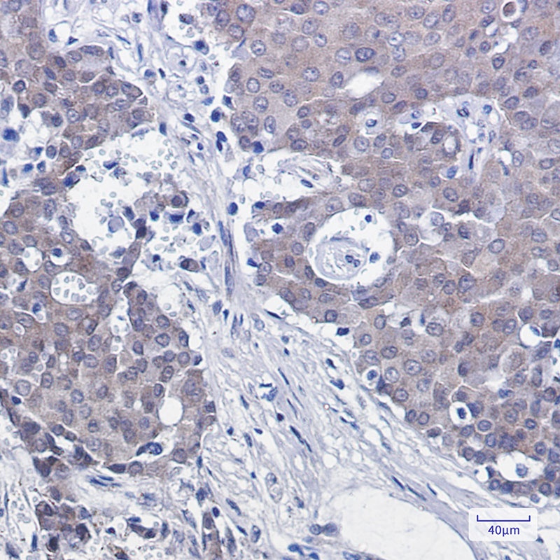 NEDD8 Rabbit mAb