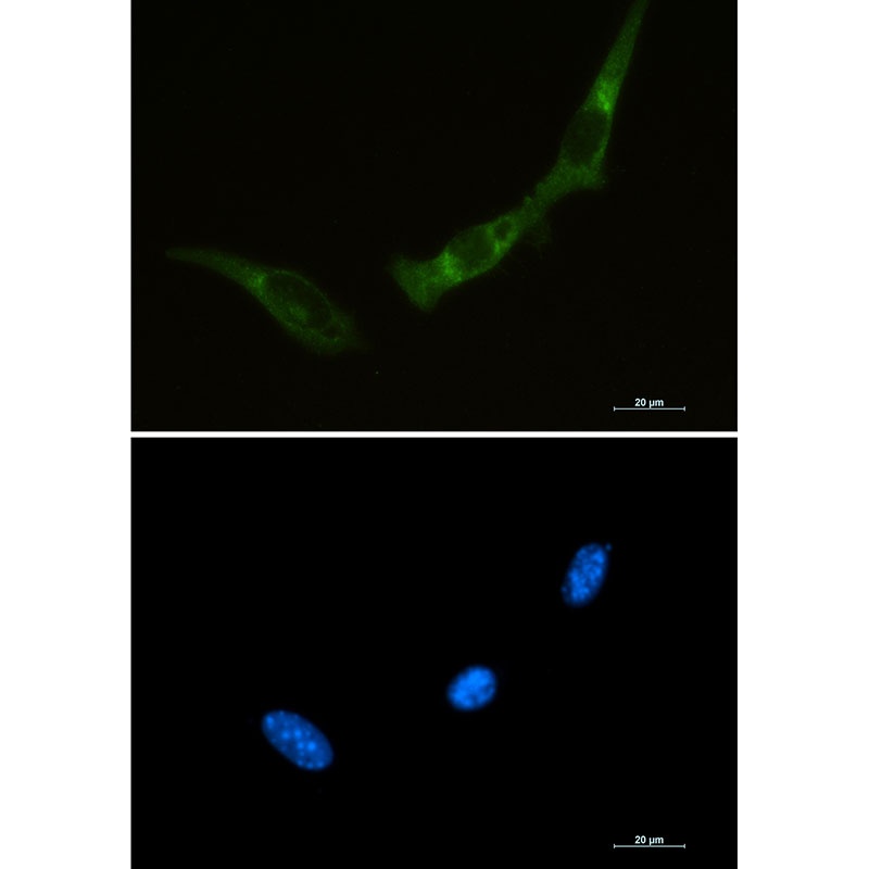 PKR Rabbit mAb