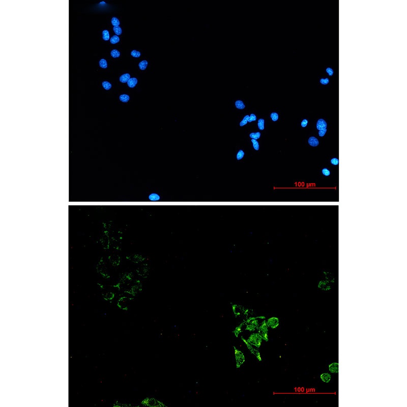 Caveolin 1 Rabbit mAb