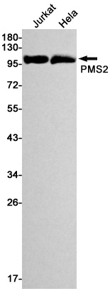 PMS2 Antibody