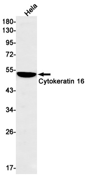 KRT16 Antibody