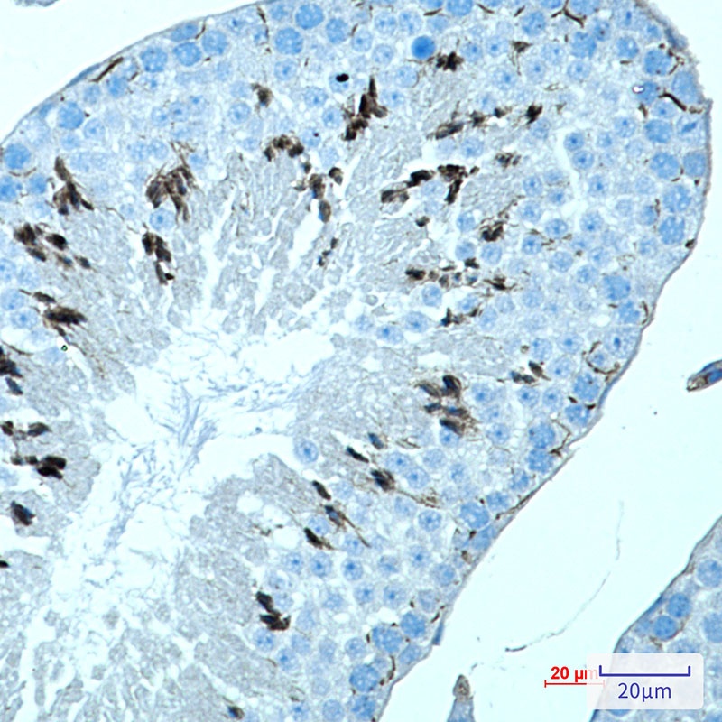 MAGEC2 Antibody