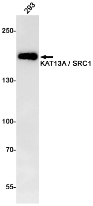 KAT13A Rabbit mAb