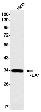 TREX1 Rabbit mAb