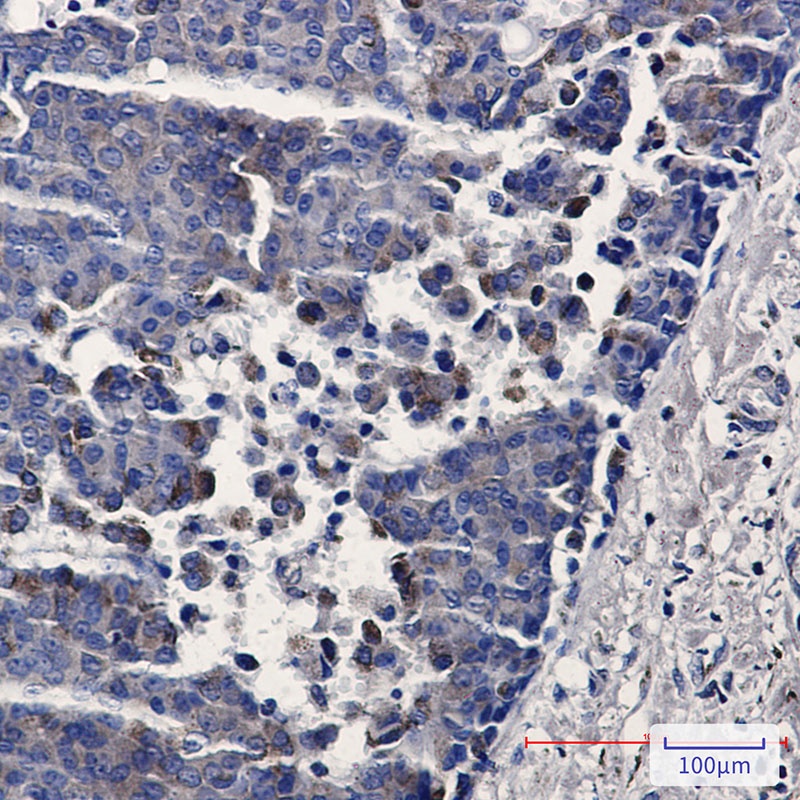 TREX1 Rabbit mAb