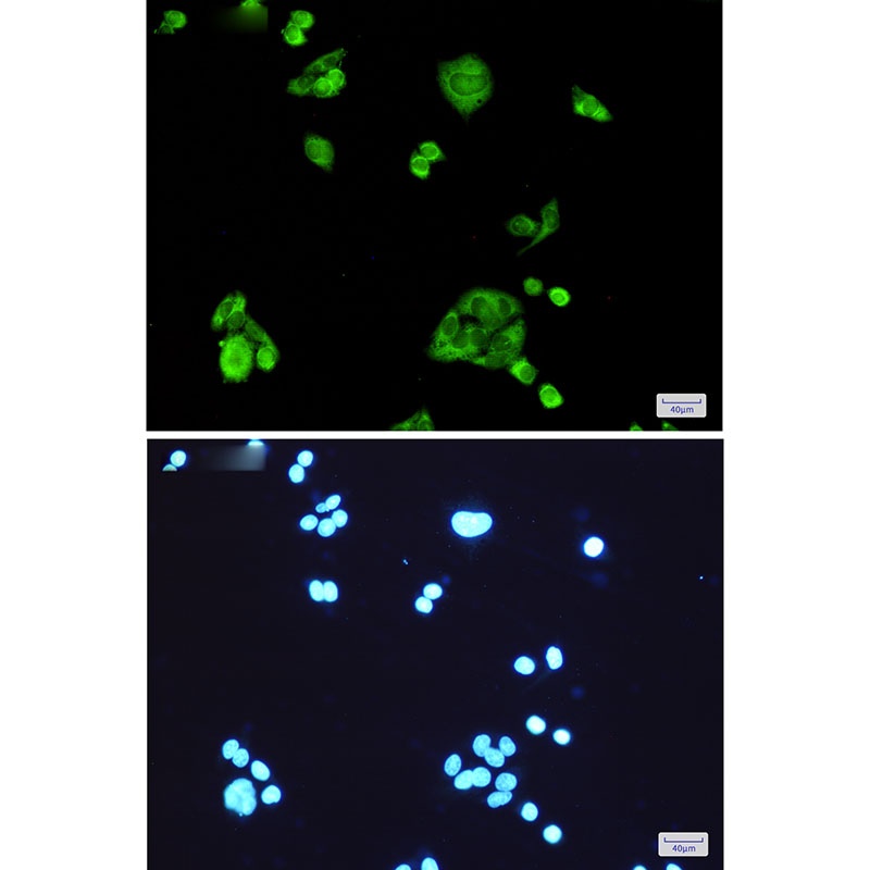 PGD Rabbit mAb