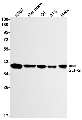 SLP2 Rabbit mAb