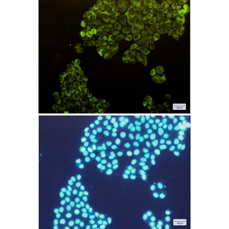 Fructose 6 Phosphate Kinase Rabbit mAb