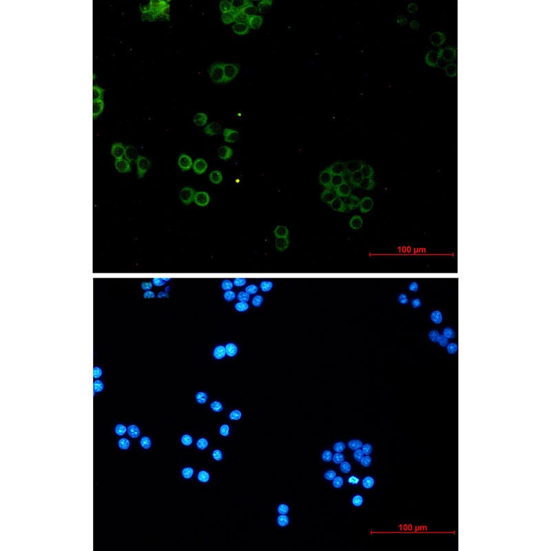 SNX5 Rabbit mAb