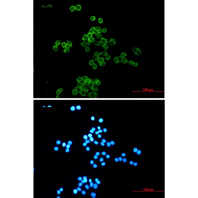 Desmocollin 3 Rabbit mAb