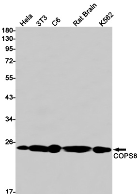 COPS8 Rabbit mAb