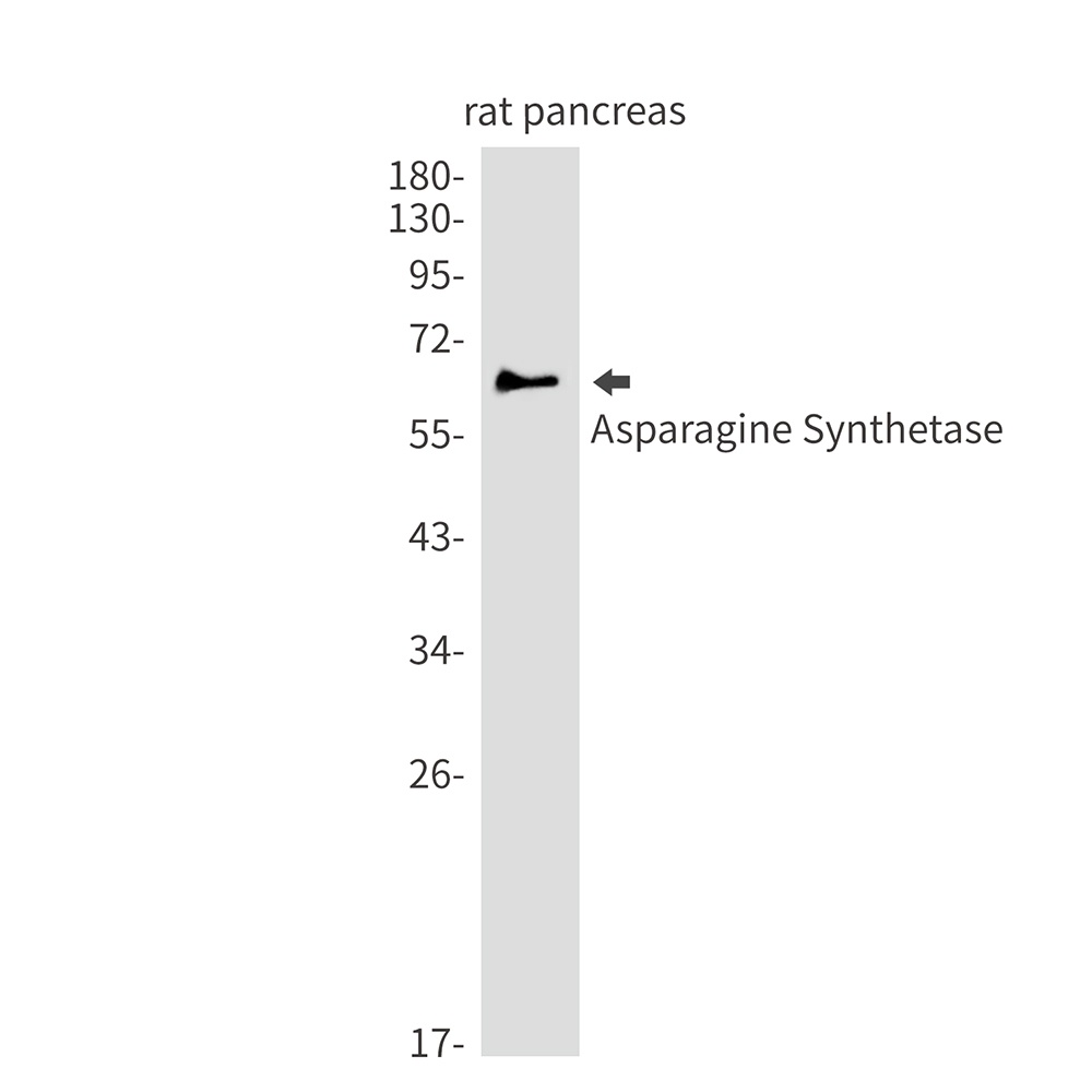 ASNS Antibody