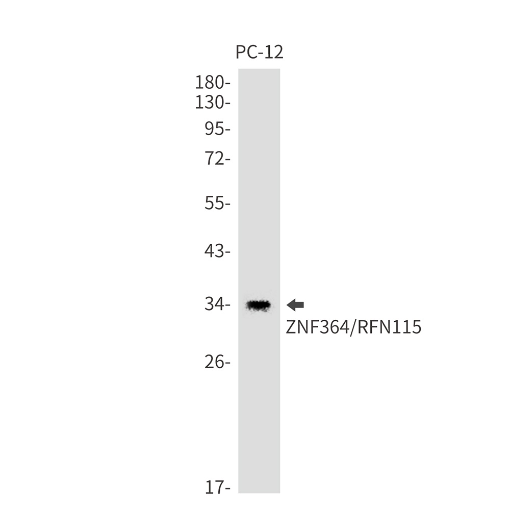ZNF364 Rabbit mAb