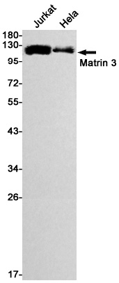 Matrin 3 Rabbit mAb