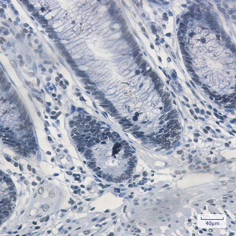 Matrin 3 Rabbit mAb