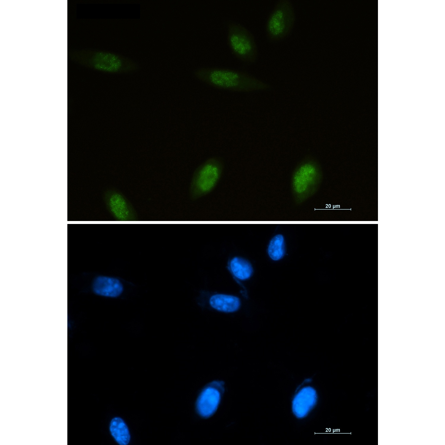 Islet 1 Rabbit pAb