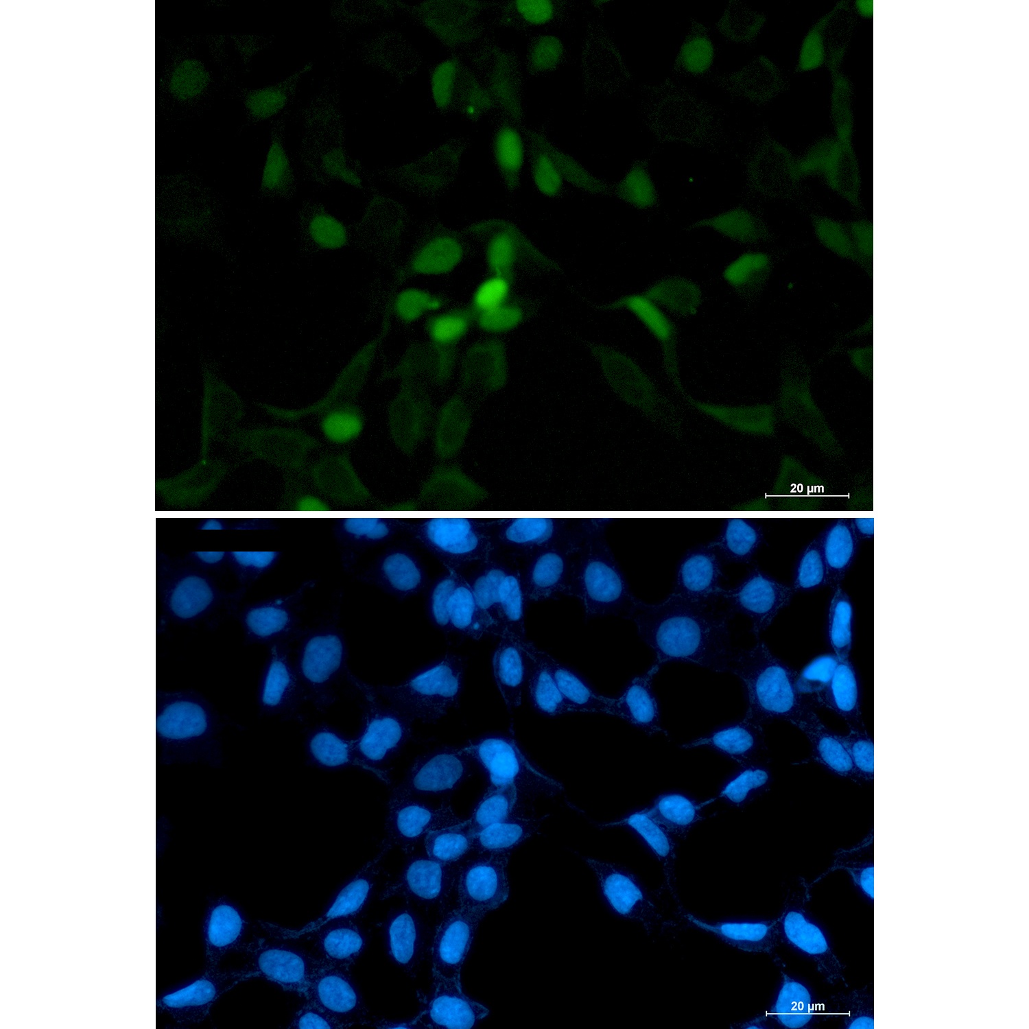 CDT1 Antibody