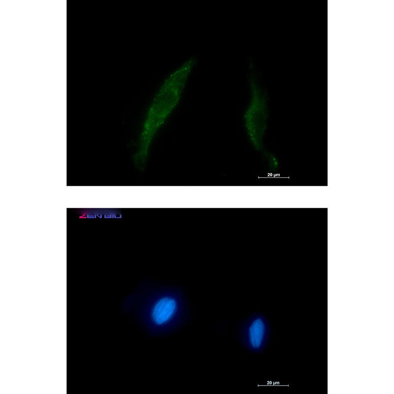 Smad2/3 Rabbit pAb