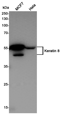 Cytokeratin 8 Rabbit pAb