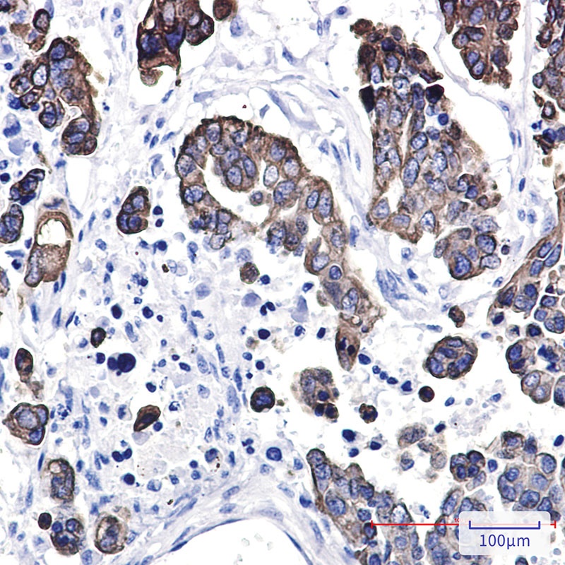 Cytokeratin 8 Rabbit pAb