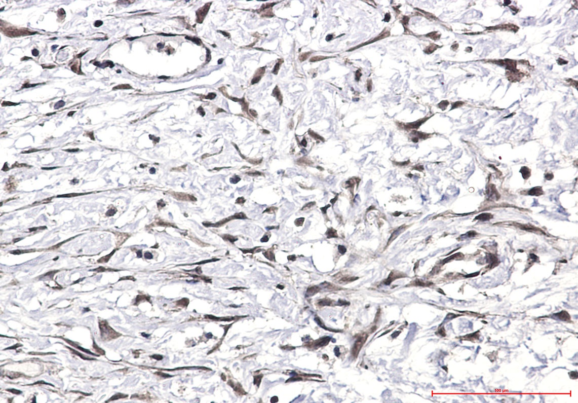 Ubiquitin Rabbit pAb