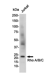 RHOA/RHOB/RHOC Antibody