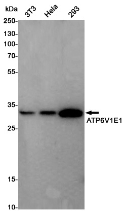 ATP6V1E1 Rabbit pAb