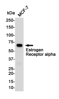 Estrogen Receptor alpha Rabbit pAb