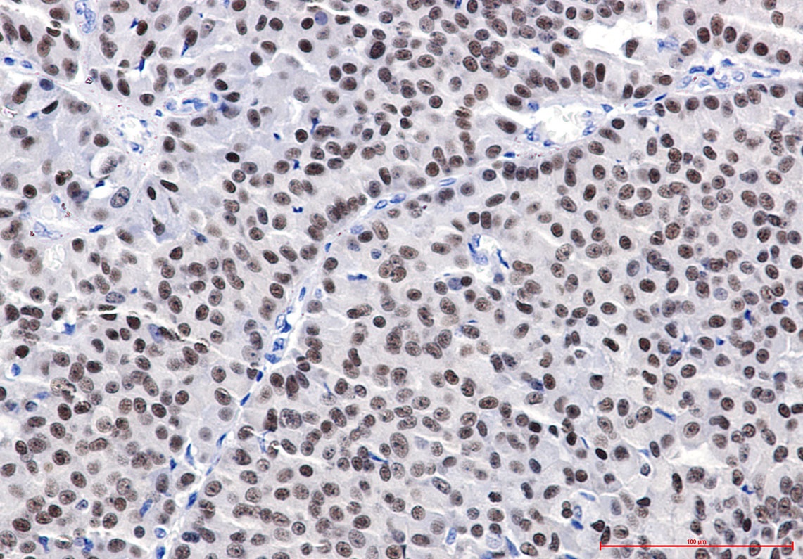 Estrogen Receptor alpha Rabbit pAb