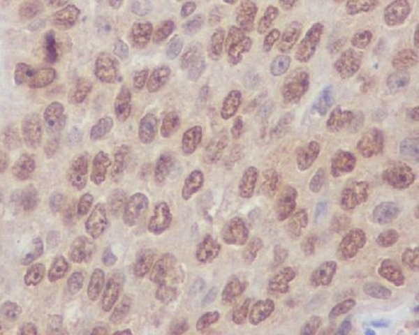 RHOA/RHOB/RHOC Antibody