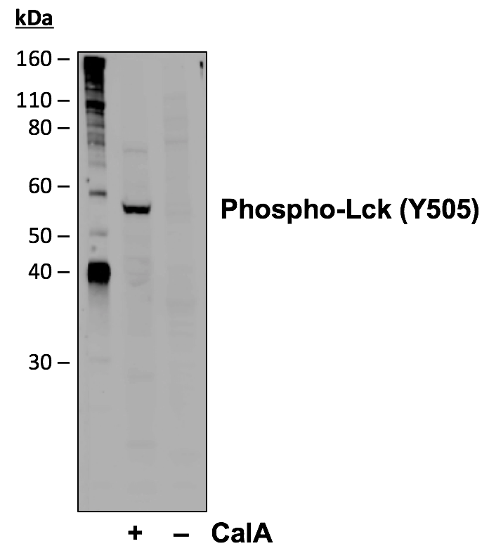 Phospho-Lck (Tyr505) (A3) rabbit mAb