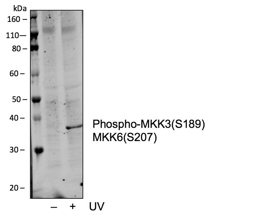 Phospho-MKK3 (Ser189)/MKK6 (Ser207) (D3) rabbit mAb Antibody