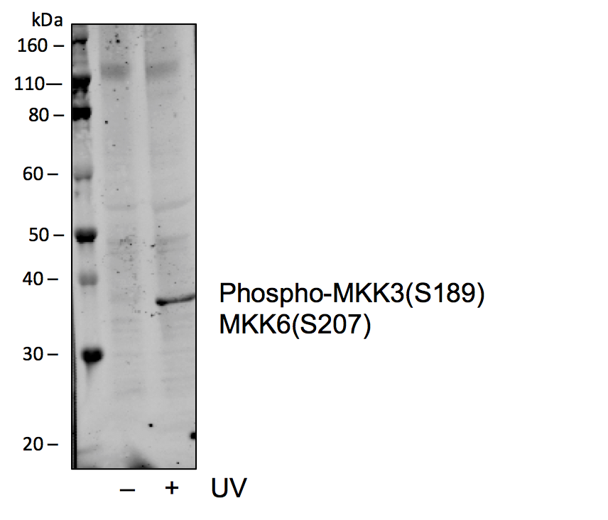 Phospho-MKK3 (Ser189)/MKK6 (Ser207) (D3) rabbit mAb