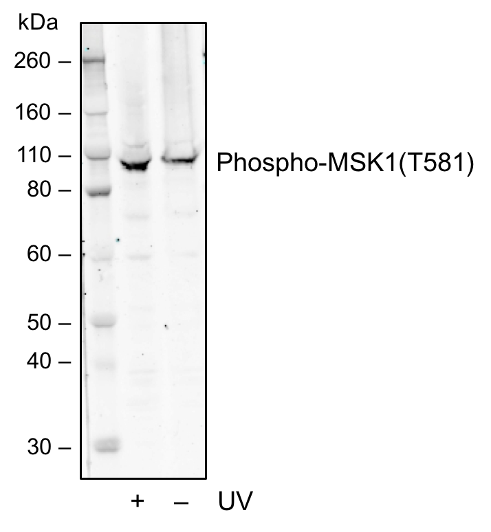 Phospho-MSK1 (Thr581) (A5) rabbit mAb Antibody