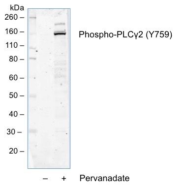 Phospho-PLCγ2 (Tyr759) (G3) rabbit mAb Antibody