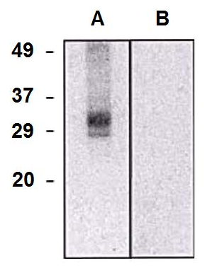 CLIC5a antibody