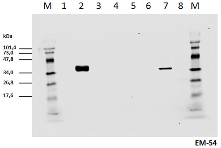 CD3 zeta (Phospho-Tyr142) antibody