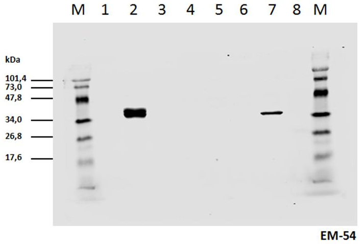 Anti-Hu CD3 zeta (pY142) Purified