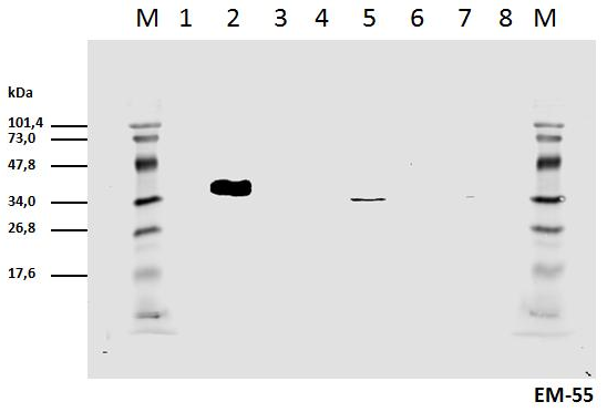 Anti-Hu CD3 zeta (pY111) Purified