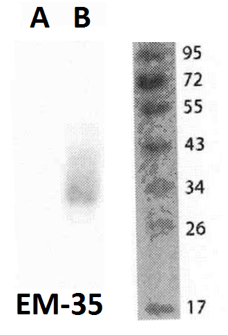 FOLR2 antibody