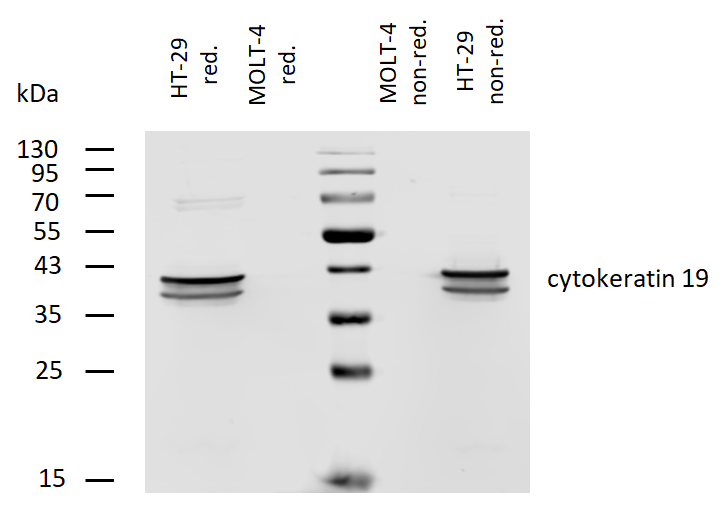 Cytokeratin 19 antibody (Biotin)
